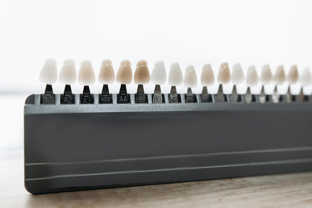 Füllungen